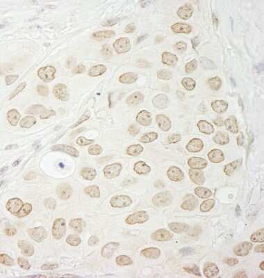 Immunohistochemistry-Paraffin: Protein Phosphatase 1C gamma Antibody [NB110-40551]