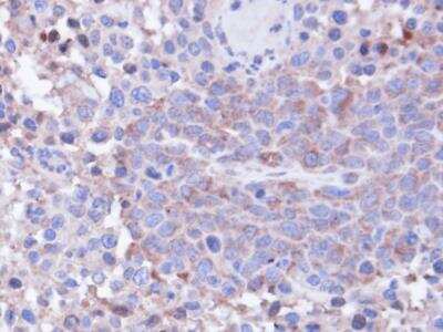 Immunohistochemistry-Paraffin: Protein Phosphatase 1C gamma Antibody [NBP1-32858]