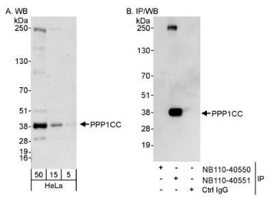 Western Blot: Protein Phosphatase 1C gamma Antibody [NB110-40551]