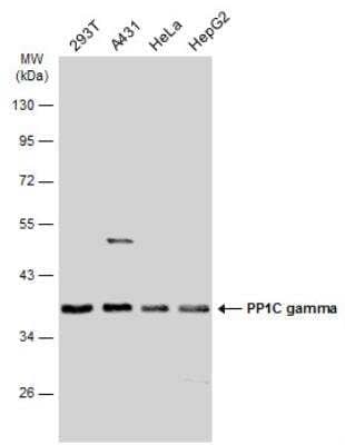 Western Blot: Protein Phosphatase 1C gamma Antibody [NBP1-32858]