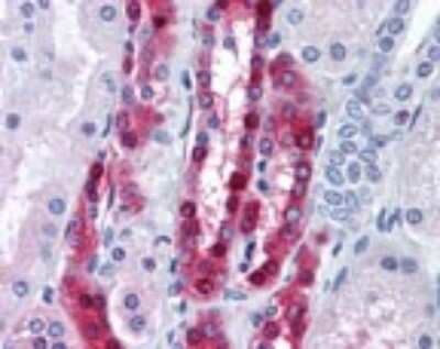 Immunohistochemistry-Paraffin: Protein Phosphatase inhibitor 1 Antibody [NBP2-24490]