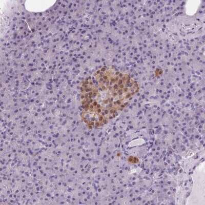 Immunohistochemistry-Paraffin: Protein Phosphatase inhibitor 1 Antibody [NBP2-37895]