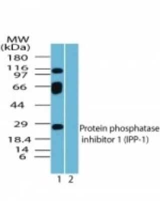 Western Blot: Protein Phosphatase inhibitor 1 Antibody [NBP2-24490]