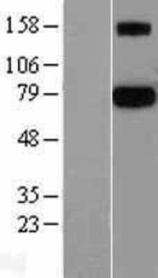 Western Blot: Protein S/PROS1 Overexpression Lysate [NBL1-14812]