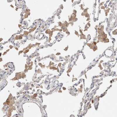 Immunohistochemistry-Paraffin: Protein S/PROS1 Antibody [NBP1-87217]