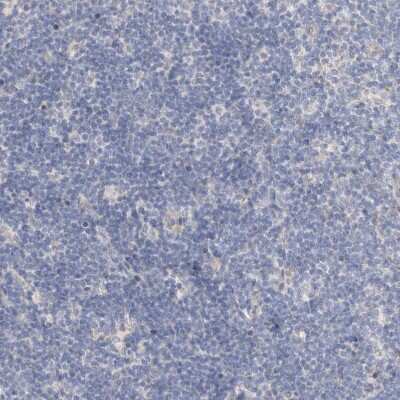 Immunohistochemistry-Paraffin: Protein S/PROS1 Antibody [NBP1-87217]