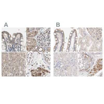 Immunohistochemistry-Paraffin: Protein S/PROS1 Antibody [NBP1-87218]