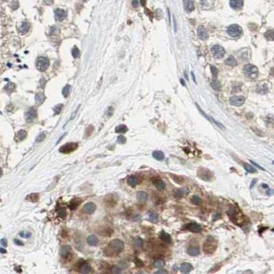 Immunohistochemistry-Paraffin: Protein S/PROS1 Antibody [NBP1-87218]