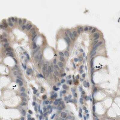 Immunohistochemistry-Paraffin: Protein S/PROS1 Antibody [NBP1-87218]