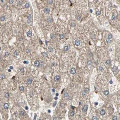 Immunohistochemistry-Paraffin: Protein S/PROS1 Antibody [NBP1-87218]