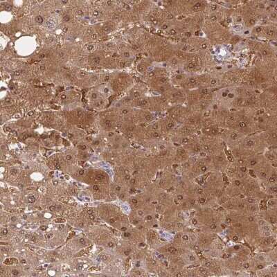 Immunohistochemistry-Paraffin: Protein Z Antibody [NBP2-49030]