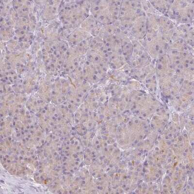 Immunohistochemistry-Paraffin: Protein Z Antibody [NBP2-49030]