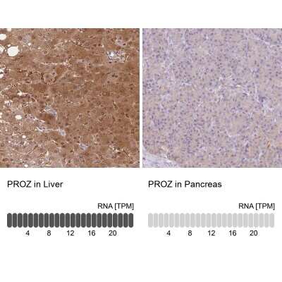 Immunohistochemistry-Paraffin: Protein Z Antibody [NBP2-49030]