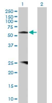 Western Blot: Protein Z Antibody [H00008858-D01P]