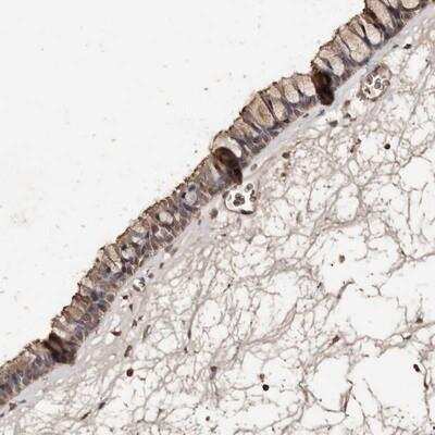 Immunohistochemistry: Protein kinase-like protein SgK493 Antibody [NBP1-80758]