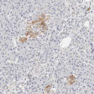 Immunohistochemistry-Paraffin: Protein kinase-like protein SgK493 Antibody [NBP1-80756]
