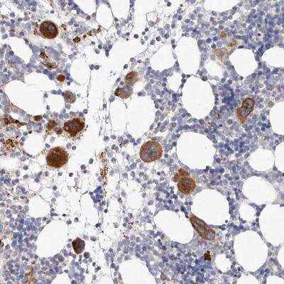 Immunohistochemistry-Paraffin: Protein kinase-like protein SgK493 Antibody [NBP1-80757]