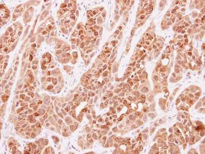 Immunohistochemistry-Paraffin: Protein kinase-like protein SgK493 Antibody [NBP2-19960]