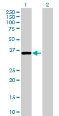 Western Blot: Protein kinase-like protein SgK493 Antibody [H00091461-B01P]