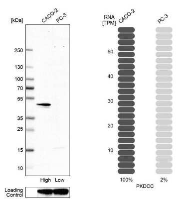 Western Blot: Protein kinase-like protein SgK493 Antibody [NBP1-80756]