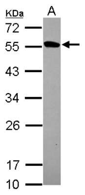 Western Blot: Protein kinase-like protein SgK493 Antibody [NBP2-19960]