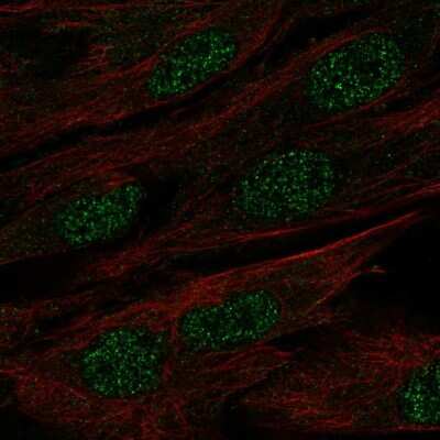 Immunocytochemistry/ Immunofluorescence: Protein mab-21-like 1 Antibody [NBP2-56150]