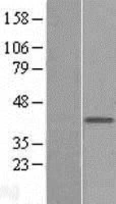 Western Blot: Protein mab-21-like 1 Overexpression Lysate [NBL1-12782]