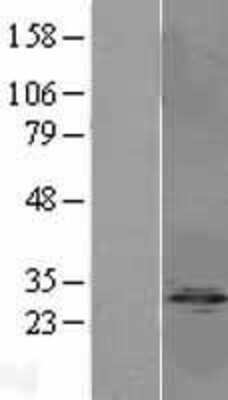 Western Blot: PP1 Inhibitor-2 Overexpression Lysate [NBL1-14682]