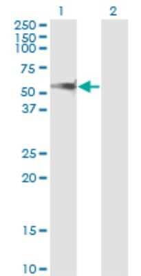 Western Blot: Protein phosphatase 1F Antibody (1G10) [H00009647-M02]