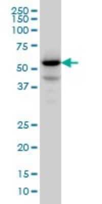 Western Blot: Protein phosphatase 1F Antibody (2A9) [H00009647-M01]