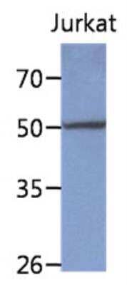 Western Blot: Protein phosphatase 1F Antibody (6D11)BSA Free [NBP2-42648]