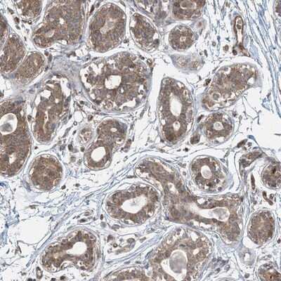 Immunohistochemistry-Paraffin: Protein phosphatase 1F Antibody [NBP1-88206]