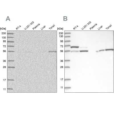 Western Blot: Protein phosphatase 1F Antibody [NBP1-88206]