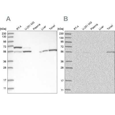 Western Blot: Protein phosphatase 1F Antibody [NBP1-88207]