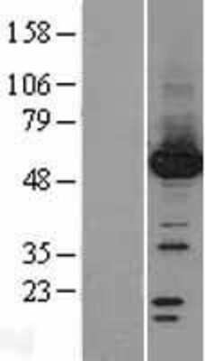 Western Blot: Protein phosphatase 1F Overexpression Lysate [NBL1-14661]