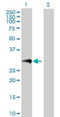 Western Blot: Proteinase 3/Myeloblastin/PRTN3 Antibody [H00005657-D01P]