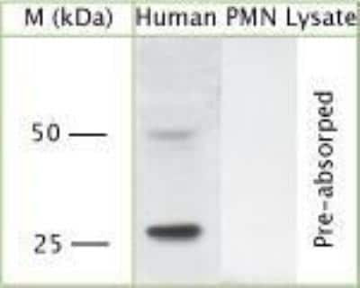 Western Blot: Proteinase 3/Myeloblastin/PRTN3 Antibody [NBP1-25966]