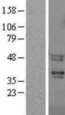 Western Blot: PAR4 Overexpression Lysate [NBL1-10411]