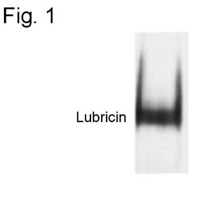 Western Blot: Lubricin/PRG4 Antibody [NB100-74453]