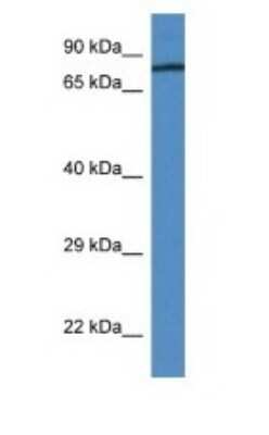 Western Blot: Coagulation Factor II/Thrombin Antibody [NBP1-74142]