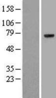 Western Blot: Prothrombin Overexpression Lysate [NBL1-10407]