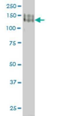 Western Blot: Protocadherin-1 Antibody (5D5) [H00005097-M01]