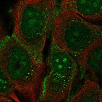 Immunocytochemistry/ Immunofluorescence: Protocadherin-1 Antibody [NBP2-47321]