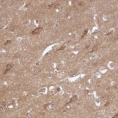 Immunohistochemistry-Paraffin: Protocadherin-1 Antibody [NBP2-47321]