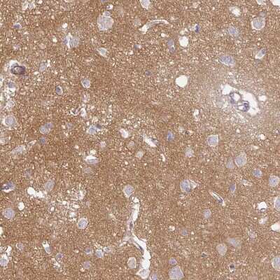Immunohistochemistry-Paraffin: Protocadherin-1 Antibody [NBP2-48968]