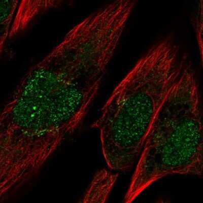 Immunocytochemistry/ Immunofluorescence: Protocadherin-10 Antibody [NBP2-57934]