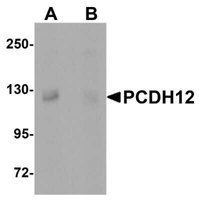 Western Blot: Protocadherin-12 AntibodyBSA Free [NBP1-77002]