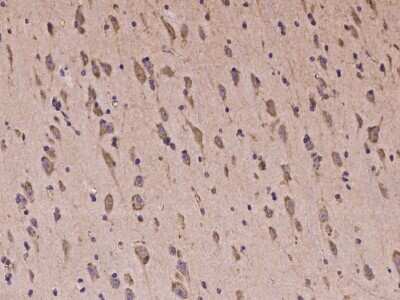 Immunohistochemistry-Paraffin: Protocadherin-18 Antibody [NBP2-97232]