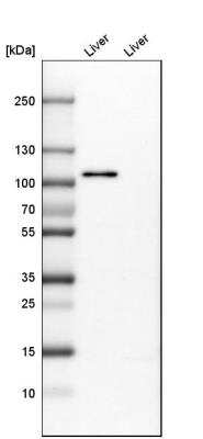 Western Blot: Protocadherin-18 Antibody [NBP1-81400]