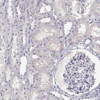 Immunohistochemistry-Paraffin: Protocadherin 21 Antibody [NBP1-92296]